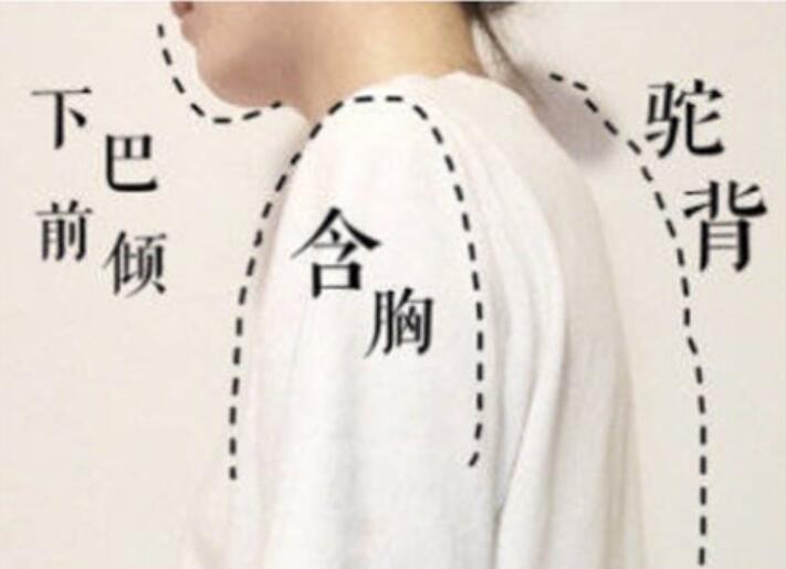 南寧美容學校：堅持一個月，駝背變直背