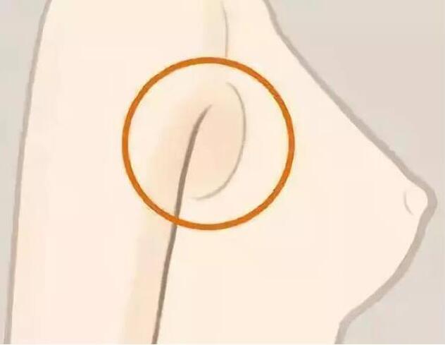 減副乳，瘦手臂一招就解決！