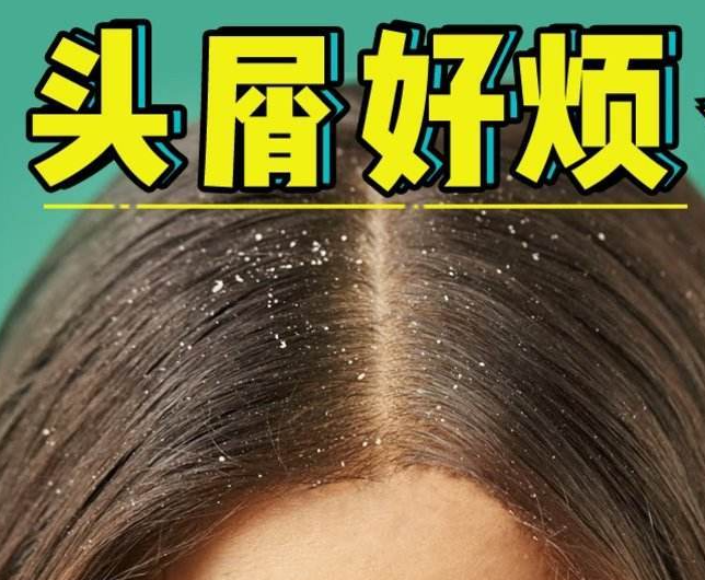 南寧正規(guī)美發(fā)培訓(xùn)學(xué)校分享：冬天如何減少頭屑過多？