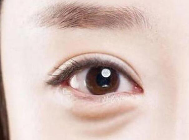 眼袋？淚溝？臥蠶？南寧美容學(xué)校教你辨別