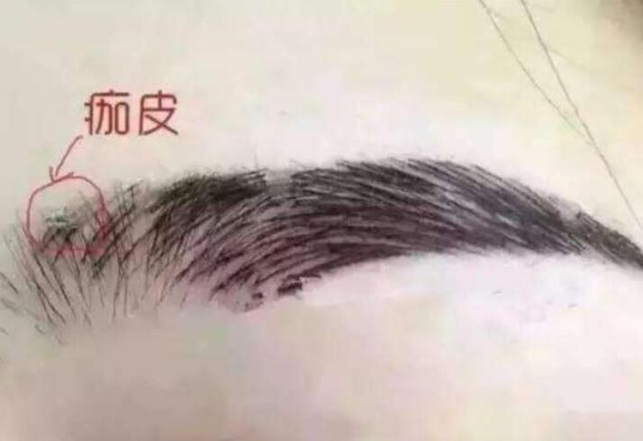 紋眉結(jié)痂時(shí)要注意什么？麗紋竹繡學(xué)校教你
