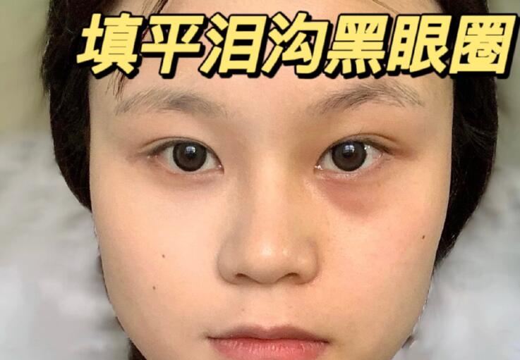 填平淚溝黑眼圈教程，廣西南寧化妝學校分享