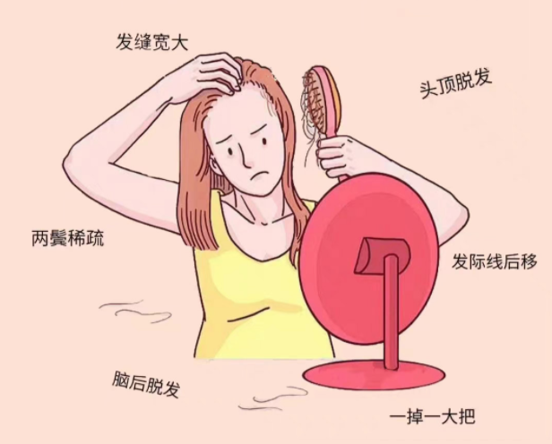 如何緩解脫發(fā)？廣西頭療養(yǎng)生培訓學校分享