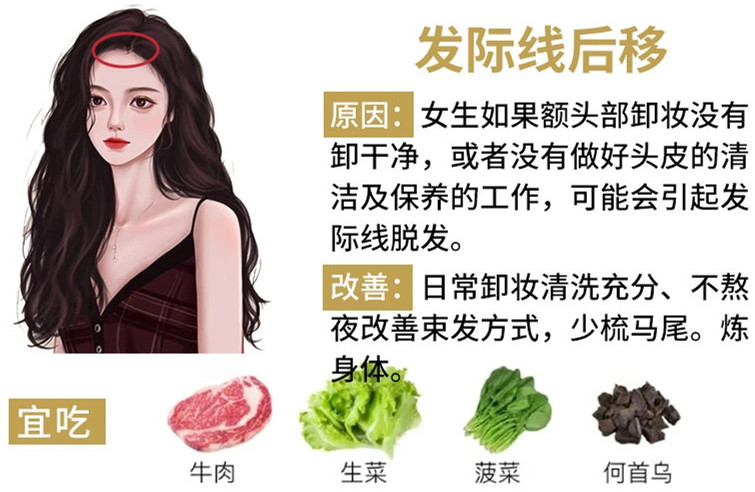 如何改善掉頭發(fā)？南寧頭療養(yǎng)發(fā)護發(fā)教學