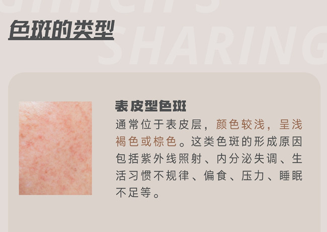 關(guān)于色斑，你需要了解這些 | 南寧皮膚管理職業(yè)學(xué)校